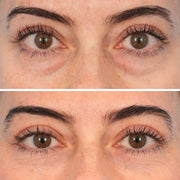 InstaLift PDRN & Collagen Eye Patches