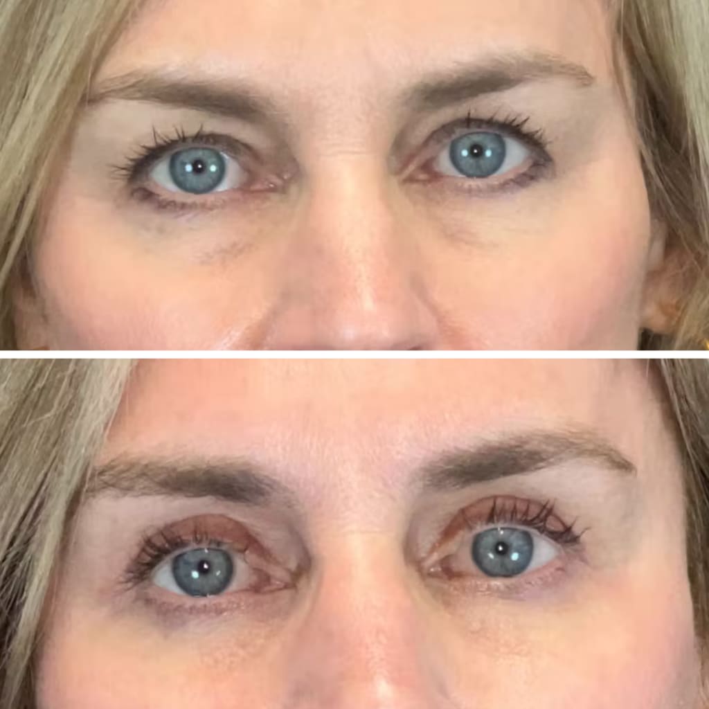 InstaLift PDRN & Collagen Eye Patches