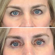 InstaLift PDRN & Collagen Eye Patches