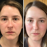 InstaLift PDRN & Collagen Eye Patches