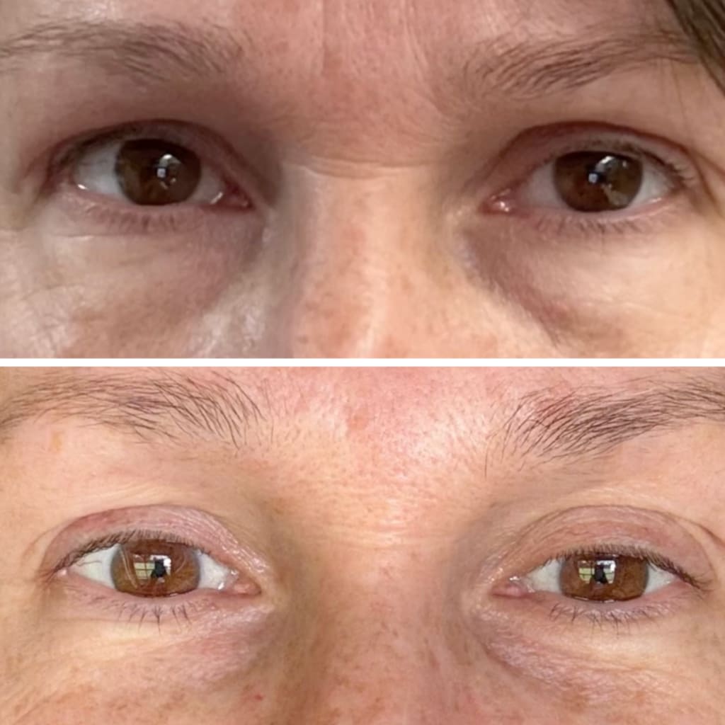 InstaLift PDRN & Collagen Eye Patches