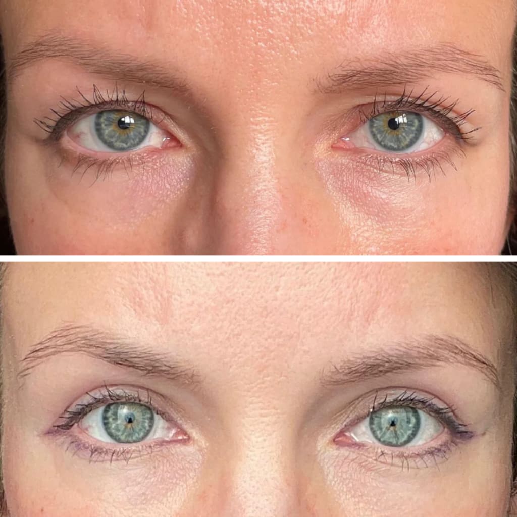 InstaLift PDRN & Collagen Eye Patches